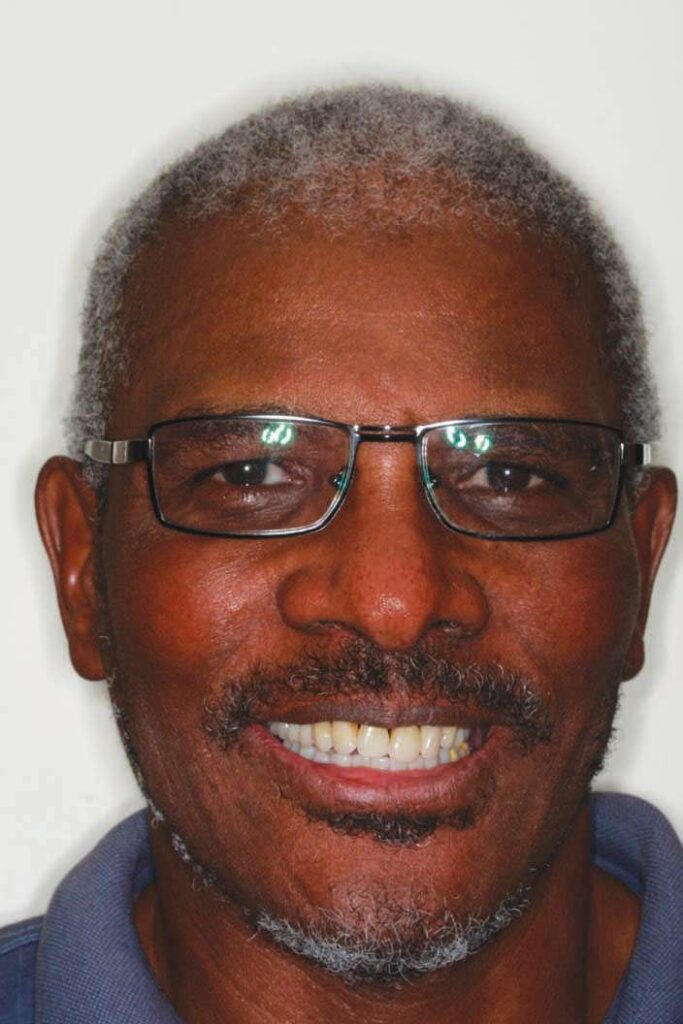 Dental Implants 23 patient smiles