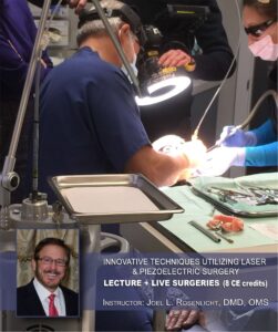 Joel L. Rosenlicht CO2 laser workshop