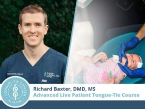 baxter tongue tie course