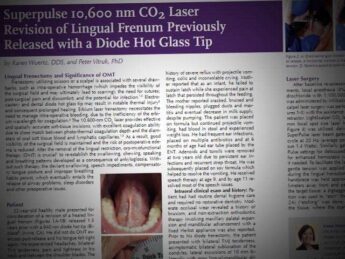 co2 laser revision of lingual frenum