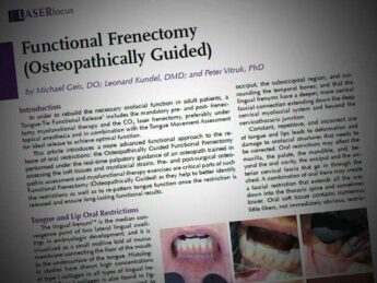 functional frenectomy laser