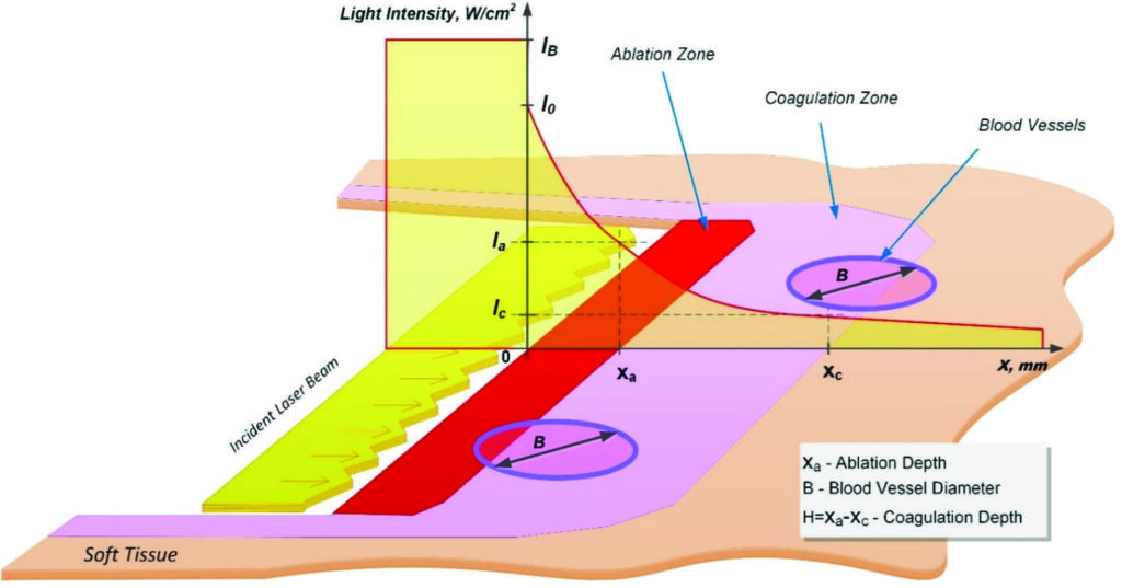  Simplified graphical representation of laser beam intensity 
