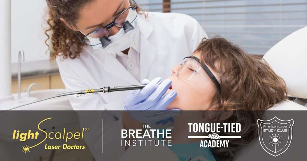 laser tongue tie doctors list