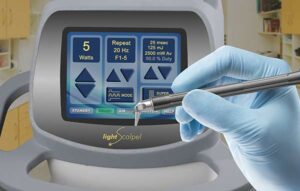 LightScalpel dental laser