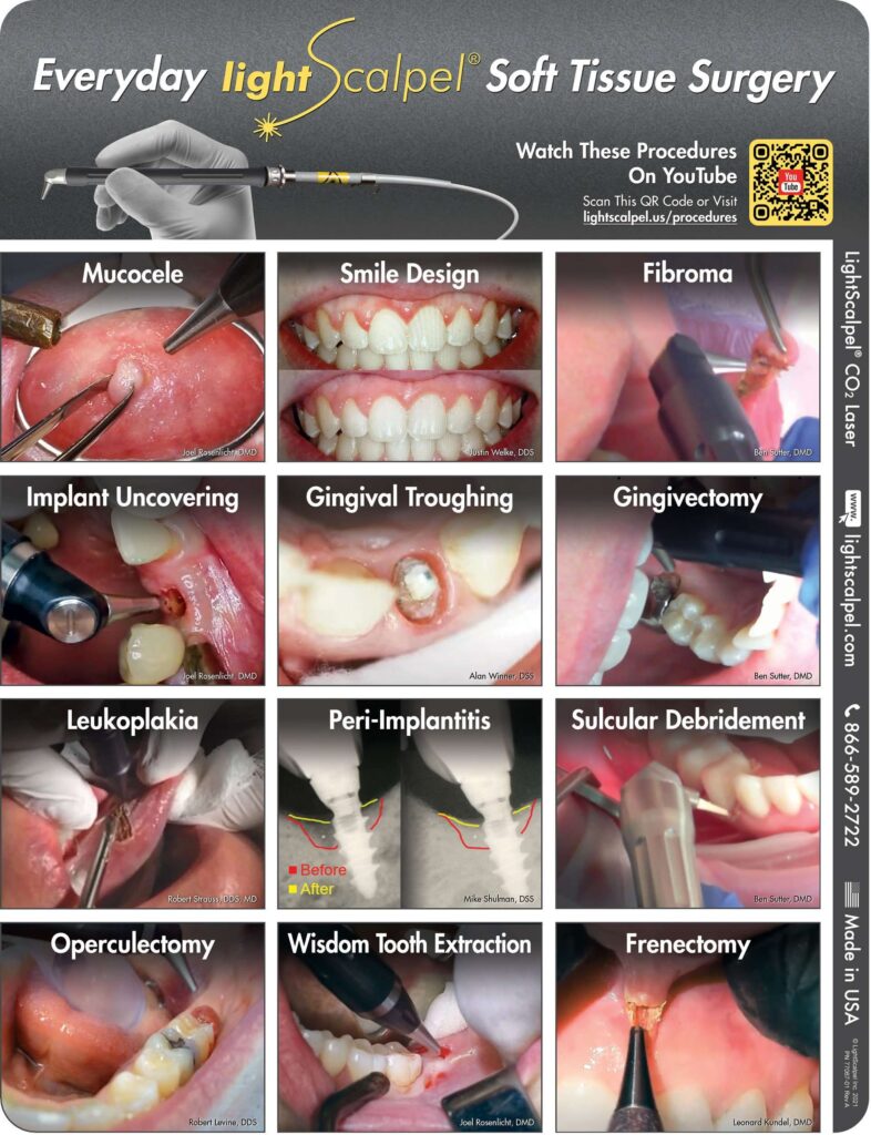 LightScalpel procedures