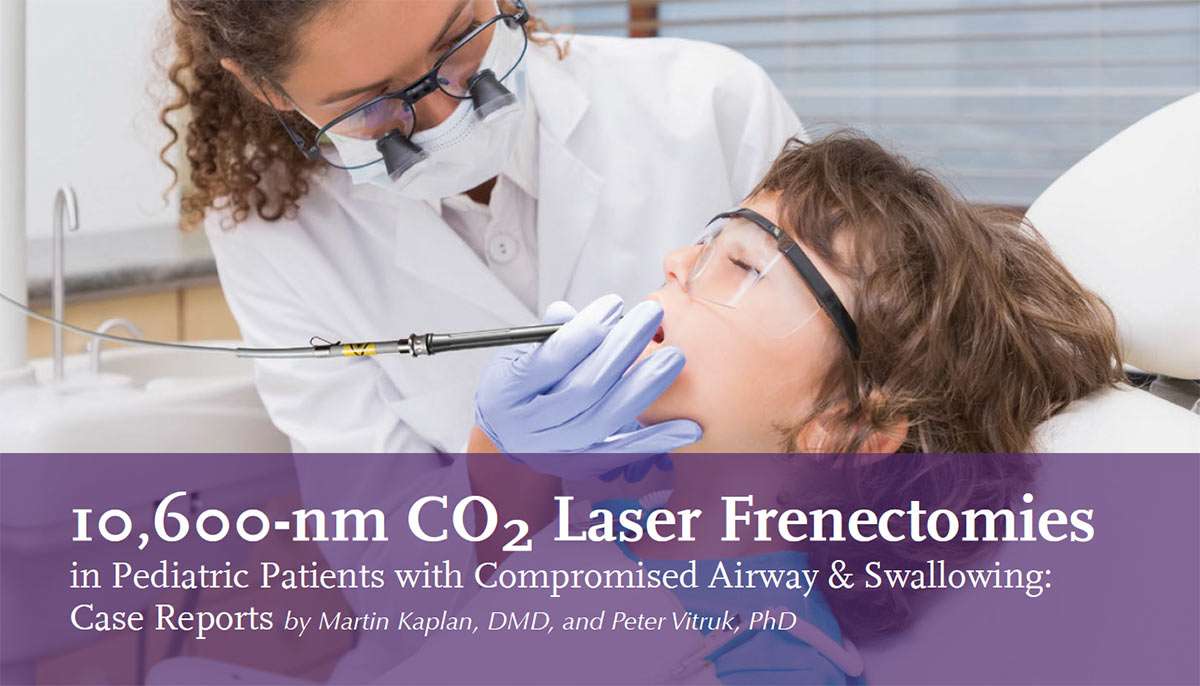 pediatric co2 laser frenectomy