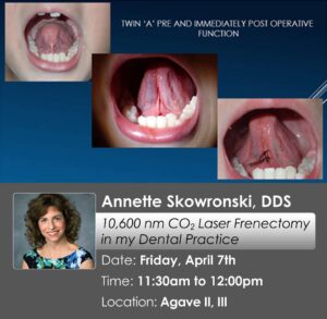 Skowronski Presentation Preview