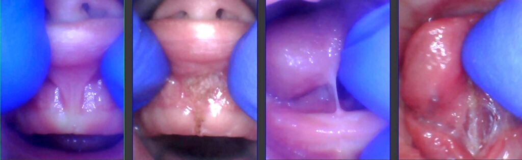 Figure 3: This 2-week-old baby